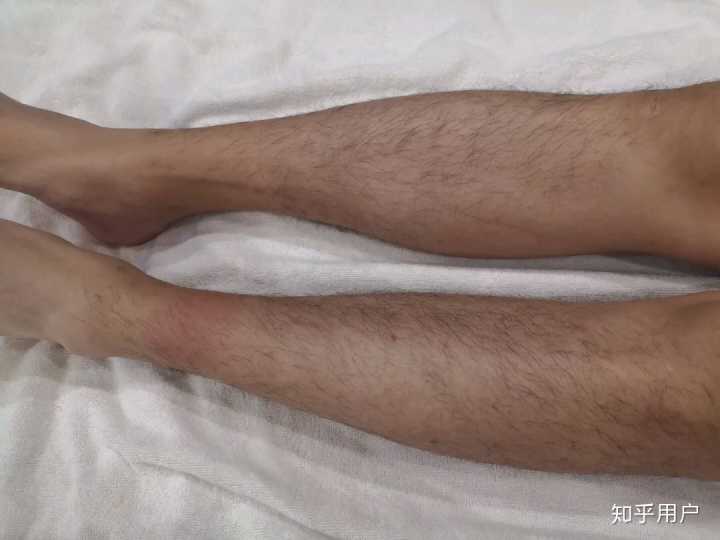 男生腿毛能刮吗